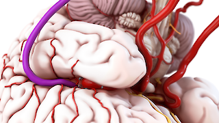 Overall view of the model from the perspective of surgery. The aneurysm can be seen in the Sylvian fissure.