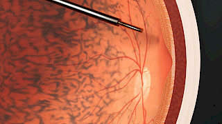 Illustration from the project «Visible Vision». Image: Ida Künzle. © ZHdK.